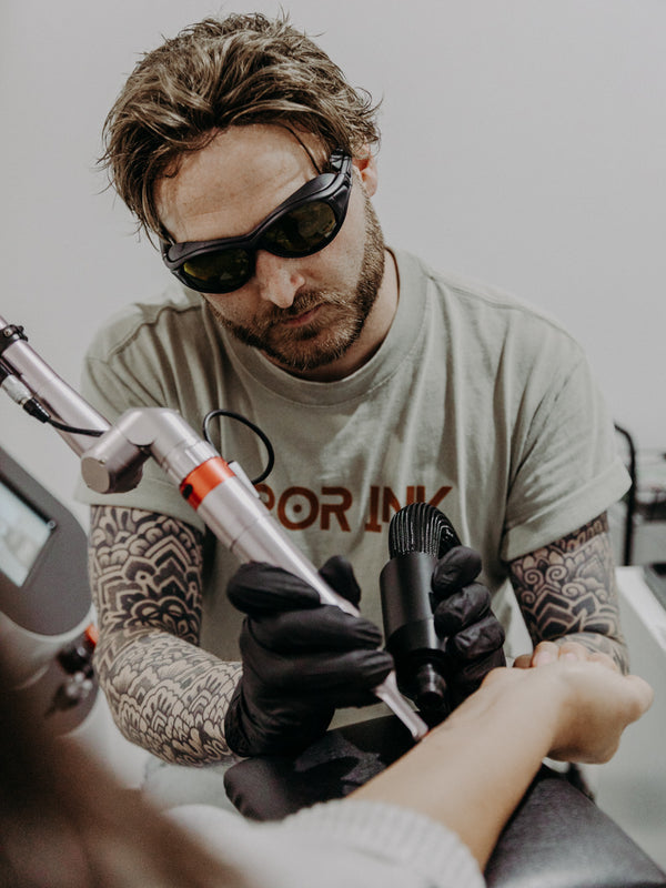 Tattoo Removal